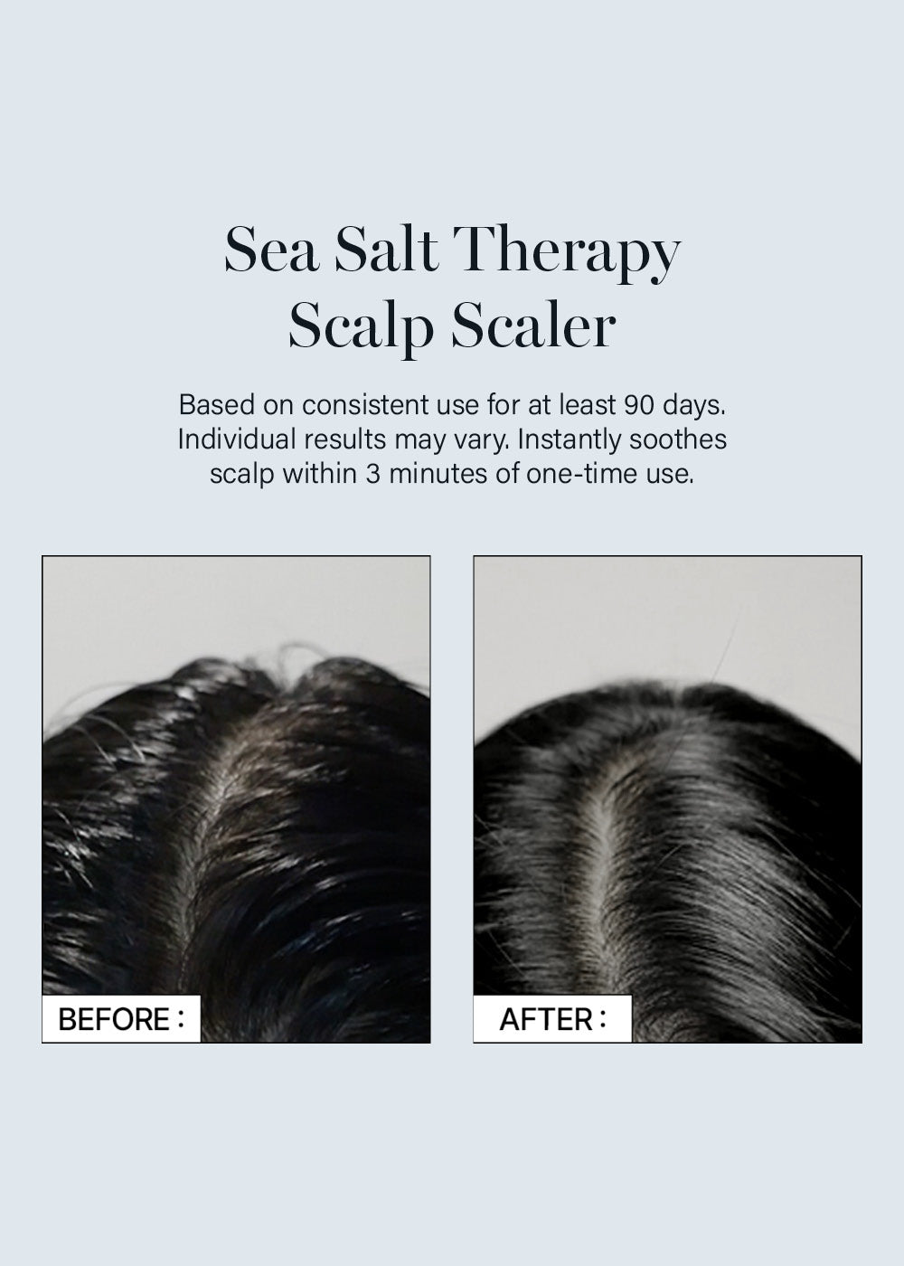 GROWUS Sea Salt Therapy Scalp Scaler 250g